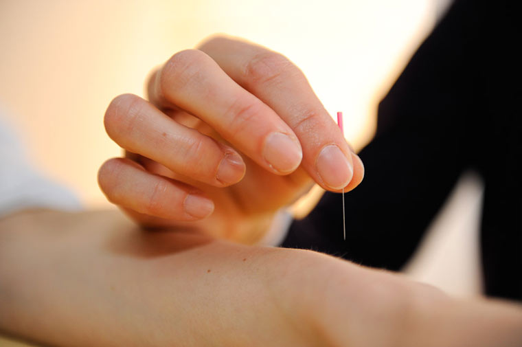 Akupunktur bei der Fachärztin Straub in Füssen